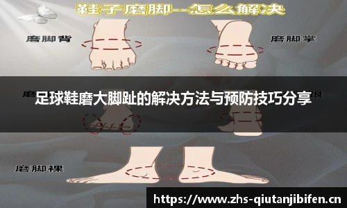 足球鞋磨大脚趾的解决方法与预防技巧分享